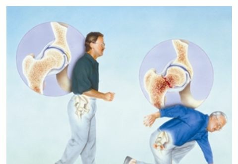黄色视频免费观看网站检测仪检测骨质疏松的真面目,黄色视频免费观看网站健康值