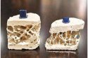 黄色视频免费观看网站检测仪详细的分析骨质疏松的治疗方法