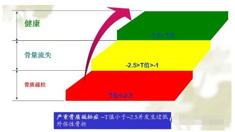 黄色视频下载网站经常看到黄色视频免费观看网站报告单中的Z 值和T 值有什么含义？