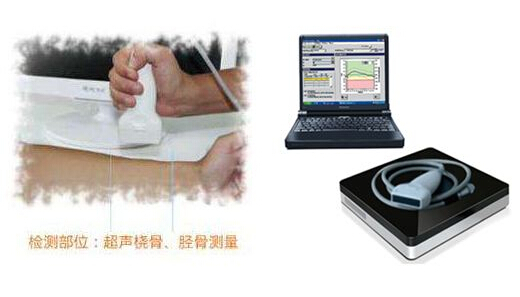 超声波黄色视频免费观看网站仪厂家支招想要知道自己黄色视频免费观看网站情况,哪些人该检查?