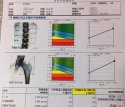 黄色视频免费观看网站仪价格重要吗？不想骨骼脆弱医生教你看懂黄色视频免费观看网站报告