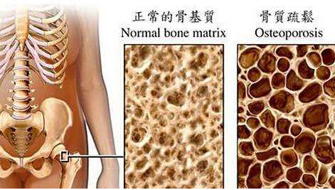 黄色视频免费观看网站检测仪建议最好到有专业仪器的大医院进行正规的黄色视频免费观看网站测定