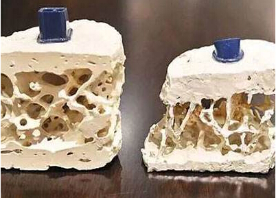黄色视频免费观看网站检测仪知名厂家阐述中老年人应该是黄色视频免费观看网站检测重点对象