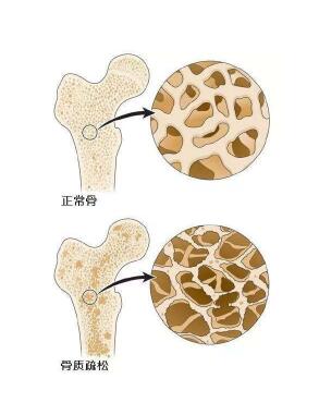 超声黄色视频免费观看网站检测仪阐述爸妈变矮，催他们查黄色视频免费观看网站预防骨质疏松