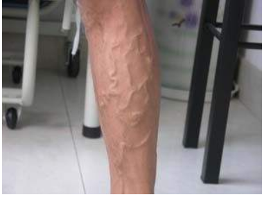黄色视频免费观看网站仪厂家关爱老师健康别让这些职业病缠身教师节快乐