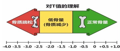 国产黄色视频免费观看网站仪三大品牌判断骨质变化当T值<-2.5存在低骨量情况