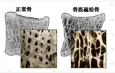 随着年龄的增长，你变矮了吗?超声波黄色视频免费观看网站仪的厂家已经揭示了他们的秘密