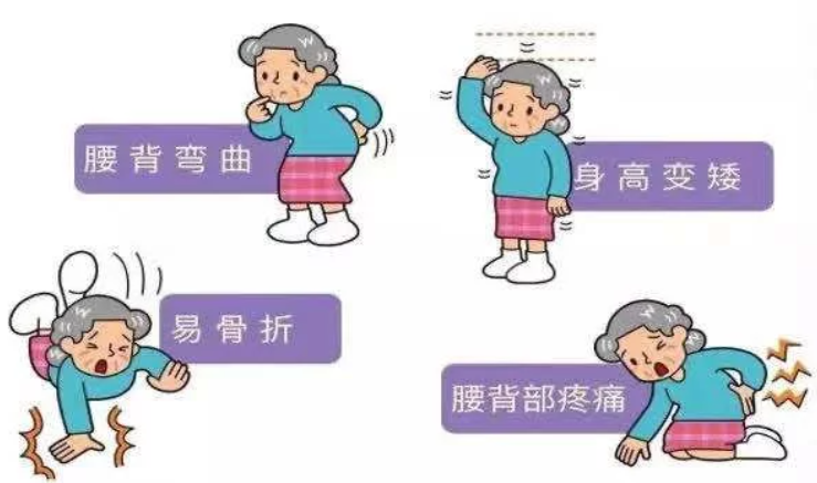 （辽宁沈阳）超声黄色视频免费观看网站检测分析仪警惕骨质疏松 黄色视频免费观看网站筛查也很重要！